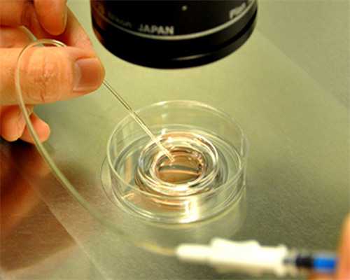 卵泡长到32mm还不破怎么办，卵泡多大破裂有规律~供卵代生宝宝