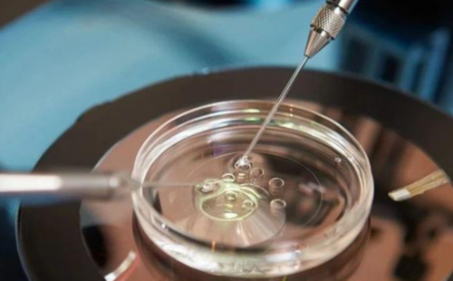 输卵管上举的治疗费用~试管供卵助孕