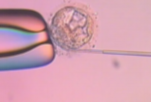 未婚怎么会有盆腔积液