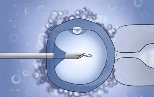 代怀小孩找人_第一代怀网,原来这四种原因，竟可能导致泰国试管婴儿取卵少