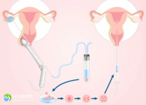 代怀儿子_代怀代妈,北京小儿内科疾病医院治疗一次花费-南京代怀供卵公司-试