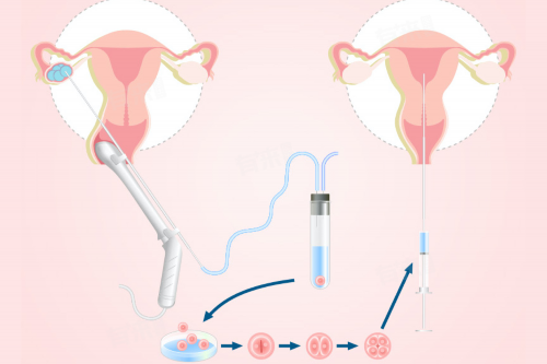 太原代怀价格明细，太原卵巢早衰试管医院大全