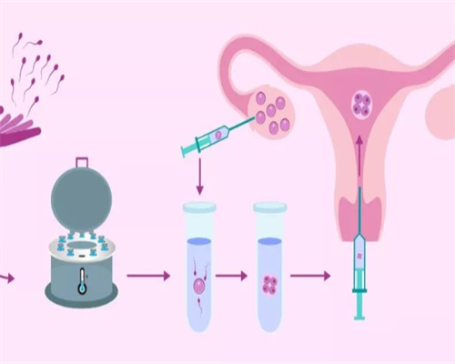 子宫内膜息肉宫腔镜手术后多久可以怀孕！子宫内膜息肉做完宫腔镜手术后多久可以同房！~公立代生价格