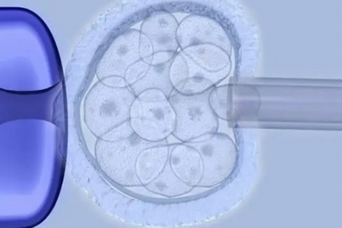 多囊卵巢综合征可以做试管婴儿