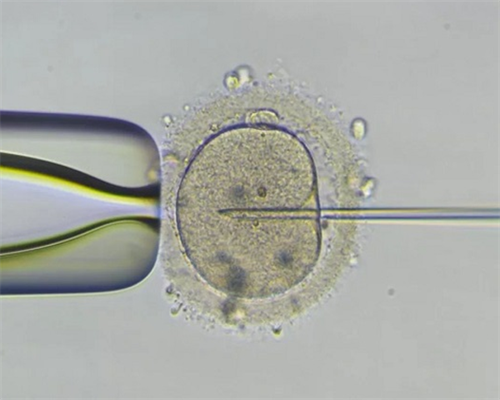 包男孩太原代孕套餐，太原宫腔粘连治疗费用多少
