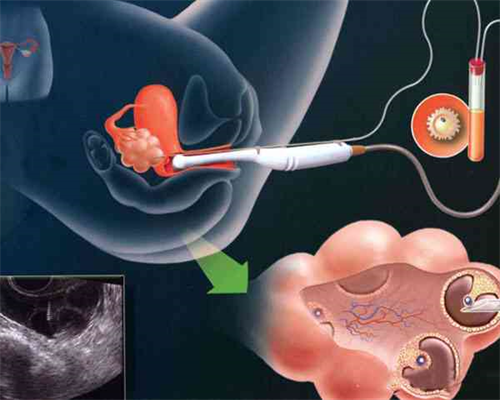 为什么试管移植后排卵试纸会出现两道杠？~助孕代怀医院