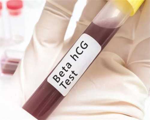 唐氏综合症是什么病