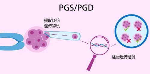 太原有供卵代孕吗，太原宫腔粘连治疗费用多少