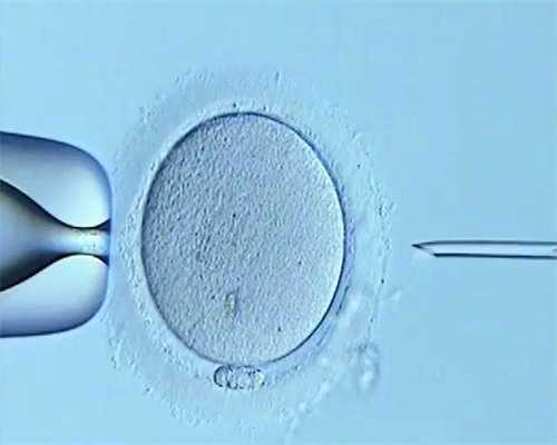 痛风影响精子质量吗~代怀产子价格